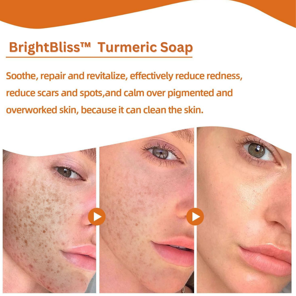 TurmeriTone™ Skin Perfector - Turmeric Soap