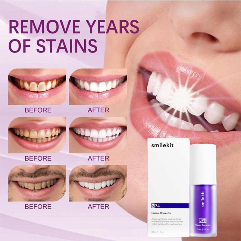 SunnySmile v34™ Dental Color Corrector